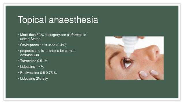 Anaesthesia for cataract surgery