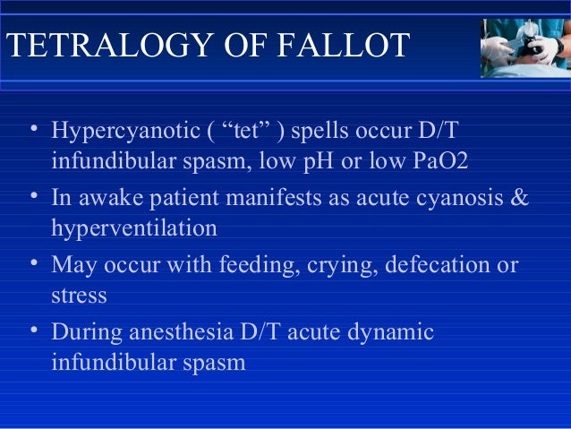 Anaesthesia for congenital heart disease