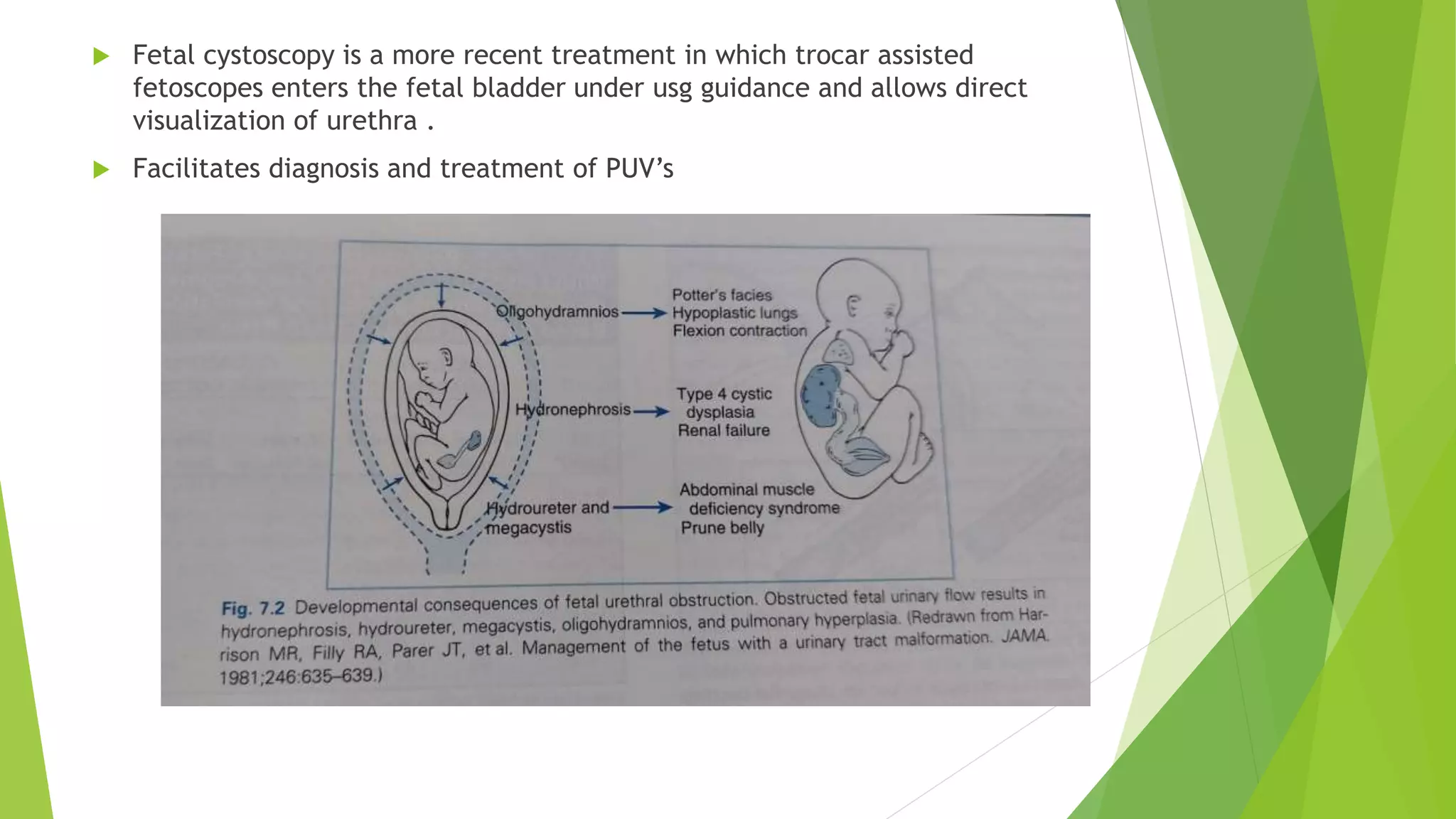 anaesthesia for fetal surgery.pptx