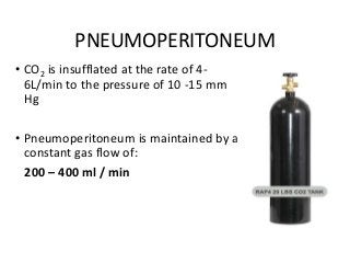 PNEUMOPERITONEUM
• CO2 is insufflated at the rate of 4-
6L/min to the pressure of 10 -15 mm
Hg
• Pneumoperitoneum is maintained by a
constant gas flow of:
200 – 400 ml / min
 