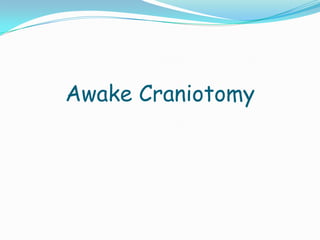Awake Craniotomy
 