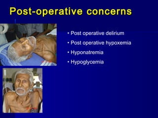 Post-operative concerns

          • Post operative delirium
          • Post operative hypoxemia
          • Hyponatremia
          • Hypoglycemia
 