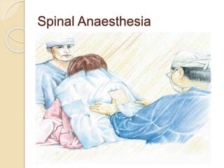 Spinal Anaesthesia
 