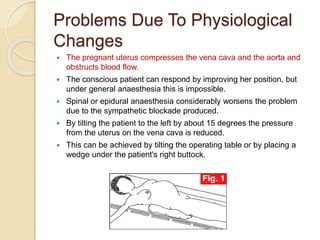 Problems Due To Physiological
Changes
 The pregnant uterus compresses the vena cava and the aorta and
obstructs blood flow.
 The conscious patient can respond by improving her position, but
under general anaesthesia this is impossible.
 Spinal or epidural anaesthesia considerably worsens the problem
due to the sympathetic blockade produced.
 By tilting the patient to the left by about 15 degrees the pressure
from the uterus on the vena cava is reduced.
 This can be achieved by tilting the operating table or by placing a
wedge under the patient's right buttock.
 