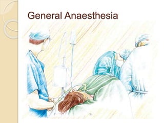 General Anaesthesia
 