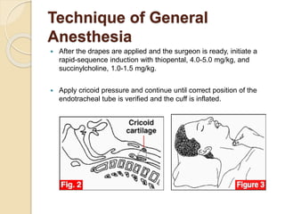 Technique of General
Anesthesia
 After the drapes are applied and the surgeon is ready, initiate a
rapid-sequence induction with thiopental, 4.0-5.0 mg/kg, and
succinylcholine, 1.0-1.5 mg/kg.
 Apply cricoid pressure and continue until correct position of the
endotracheal tube is verified and the cuff is inflated.
 