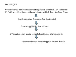 Comprehensive Guide to Anaesthesia Techniques in Ocular Surgery | PPTX