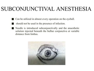 Limbus Injected Comprehensive Guide to Anaesthesia Techniques in Ocular Surgery | PPTX