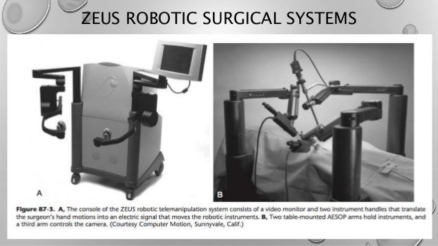 aesop robotic surgical system