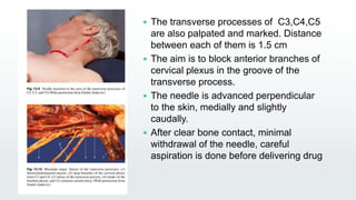 Transverse Blocking Anaesthesia Management Thyroid by Dr. Animesh | PPTX