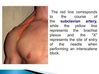 anaesthesia PPT (1).pdf, analgesics, injection | PDF