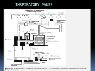 Anaesthesia ventilators | PPTX