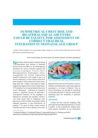 1.Assistant Professor, 2.Associate Professor, 3.Associate Professor, 4. Professor and HOD
Department ofAnaesthesia, Gajra Raja Medical College Gwalior (M.P.).
Newly born needs tracheal intubation during
resuscitation post delivery, in Neonatal
Intensive Care Unit (NICU) or to provide general
anasthesia for various neonatal surgeries like
Tr a c h e o - e s o p h a g e a l F i s t u l a ( T E F ) ,
Meningomyelocele, Diaphragmatic hernia,
ompahalocele etc. Correct endotracheal
tube(ETT) placement in this subset of age is of
utmost importance, as their airways varies from
adult airways in many aspects like narrow nares,
large head and tongue, small pharynx, floppy
epiglottis and higher anterior funnel shape larynx,
.ETT intubation has an approximately failure rate
1
of 8%. Developing proficiency at intubation
2
requires a significant amount of experience.
Unrecognized intubation of the esophagus is
3
followed by morbidity and mortality. Tochen’s
rule alone would lead to inadequate tube
placement in 47% of infants. Auscultation allows
adequate placement in only three-fourths of
4,5,6
patients. To avoid all these mishap various
methods have been used to identify correct tube
placementfromtimesinceETTinsertionisdonein
newborn to till date where newer technology has
7
penetrated it., as shown in (Table.1) . Thus an
array of techniques are available for confirming
correct tube placement in new born, which varies
depending upon the availability in particular
institution.
15-days old term neonate, weighing 2.4kg
with huge Occipital Meningomyelocele as shown
in (Figure. 1), was scheduled for surgical repair
under general anesthesia. As per institutional
CASE REPORT
“If that's what you think, you've got another thing coming up…an ultrasound verification of correct tube
placementinneonatalagegroup.”
Anaesthesiology M.P. 13
SYMMETRICAL CHEST RISE AND
BILATERAL EQUALAIR ENTRY
COULD BE FALSITY, FOR ASSESSMENT OF
CORRECT TRACHEAL
INTUBATION IN NEONATALAGE GROUP
1 2 3 4
lDr. Suman Gupta , Dr. Preeti Goyal , Dr. Neelima Tandon , Dr. Bhanu Choudhary
Fig1: A neonate with huge occipital Meningomyelocele
 