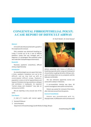 1. AssistantProfessor.
2. SeniorResident,
DepartmentofAnaesthesiology,GandhiMedicalCollege,Bhopal.
CONGENITAL FIBROEPITHELIAL POLYP;
A CASE REPORT OF DIFFICULT AIRWAY
1 2
Dr. Ruchi Tandon , Dr. Sonal Awasya
Abstract
Keywords:
Introduction
Case Report
A 9 month old child presented with a growth in
theoropharynxforremoval.
Only complaint was distressed breathing on
crying. It turned out to be a case of difficult
paediatric airway that was managed well. A
diagnoses of oesophageal fibro-epithelial polyp
wasmadeafterhistopathologicalexamination.
Neonatal, paediatric anaesthesia, difficult
airway,congenitalpolyp
As anaesthesiologists we are aware that many
a times, paediatric intubations turn out to be
difficult, and we may land up with an
unanticipated difficult airway. Paediatric
population is more at risk for hypoventilation and
hypoxia if intubation during anaesthesia is delayed
and ventilation is inadequate. An expected
“normal airway and intubation” may take an
ominousturntoCVCI.
We are reporting a very unusual case of the
same.
A child of 9 months with normal vaginal
delivery presented with history of difficulty in
breathing especially while crying and choking kind
of sound when coughing. But when child was calm,
quiet and asleep there are no complaints and the
babywascomfortable.
She was otherwise apparently normal and
activewithnodelayinmilestones.
A pre-anaesthetic checkup was done. All
routineinvestigationswerewithinnormallimits.
Patient was posted for removal of the lesion,
afterinformedconsentfromtheparents.
Patient was premedicated with Inj.
Glycopyrrolate, Inj Midazolam and Inj Fentanyl and
Course of anaesthesia:
Anaesthesiology M.P. 19
 