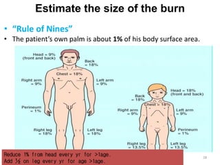 Estimate the size of the burn
• “Rule of Nines”
• The patient’s own palm is about 1% of his body surface area.
Reduce 1% from head every yr for >1age.
Add ½ on leg every yr for age >1age.
28
 