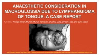 ANAESTHETIC CONSIDERATION IN
MACROGLOSSIA DUE TO LYMPHANGIOMA
OF TONGUE: A CASE REPORT
AUTHORS: Anurag Tewari, Munish Munjal, Kamakshi, Shuchita Garg, Dinesh Sood, and Sunil Katyal
Tewari A, Munjal M, Kamakshi, Garg S, Sood D, Katyal S. Anaesthetic consideration in macroglossia due to lymphangioma of tongue: a case report. Indian Journal of Anaesthesia 2009;53(1):79–83.
 