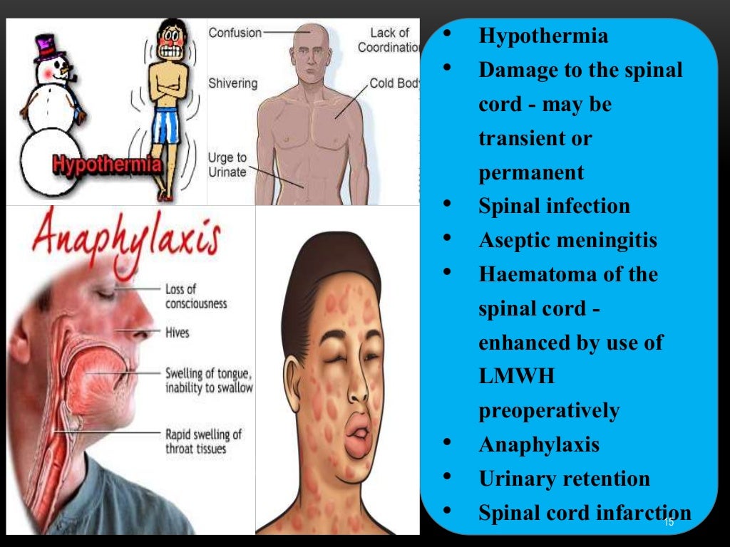 Anaesthetic Death Ppt