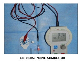 PERIPHERAL NERVE STIMULATOR
 