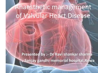 Anaesthetic management
of Valvular Heart Disease
Presented by :- Dr Ravi shankar sharma
Sanjay gandhi memorial hospital,Rewa
 