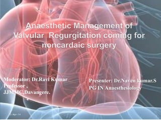 Presenter: Dr.Naven kumar.S
PG IN Anaesthesiology
Moderator: Dr.Ravi Kumar
Professor ,
JJMMC,Davangere.
22-Apr-14
1
 