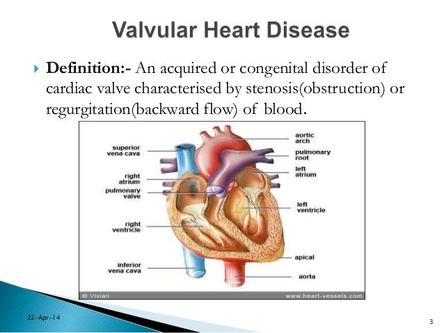 anaesthetic management of valvular heart disease for non cardiac surg valvular heart disease