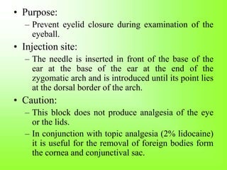 • Purpose:
– Prevent eyelid closure during examination of the
eyeball.
• Injection site:
– The needle is inserted in front of the base of the
ear at the base of the ear at the end of the
zygomatic arch and is introduced until its point lies
at the dorsal border of the arch.
• Caution:
– This block does not produce analgesia of the eye
or the lids.
– In conjunction with topic analgesia (2% lidocaine)
it is useful for the removal of foreign bodies form
the cornea and conjunctival sac.
 