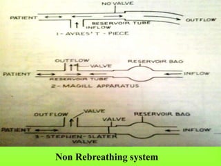 Non Rebreathing system
 