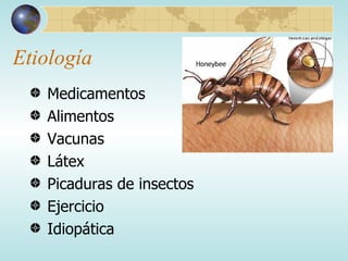 Etiología Medicamentos Alimentos Vacunas Látex Picaduras de insectos Ejercicio Idiopática 