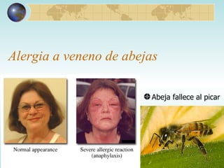 Alergia a veneno de abejas Abeja fallece al picar 