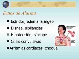 Datos de Alarma Estridor, edema laringeo Disnea, sibilancias Hipotensión, síncope Crisis convulsivas Arritmias cardiacas, choque 