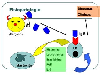 Fisiopatología
LB
Ig E
Mastocito
Histamina.
Leucotrienos.
Bradikinina.
PAF.
IL-5
Alergenos
Síntomas
Clínicos
 