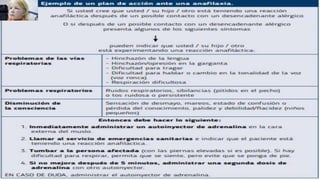 ANAFILAXIA.pptx
