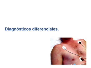 Diagnósticos diferenciales.
 