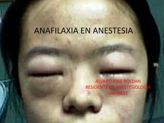 ANAFILAXIA EN ANESTESIA
ALVARO JOSE ROLDAN
RESIDENTE DE ANESTESIOLOGIA
UNIVALLE
 