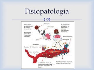 
Fisiopatologia
 