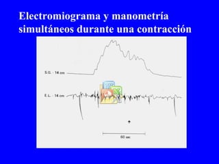 Electromiograma y manometría simultáneos durante una contracción 