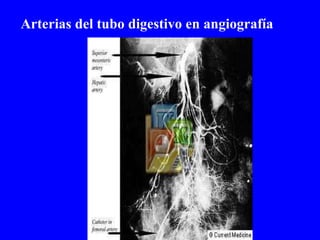 Arterias del tubo digestivo en angiografía 