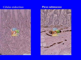 Células endocrinas Plexo submucoso 