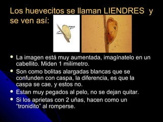 Los huevecitos se llaman LIENDRES yLos huevecitos se llaman LIENDRES y
se ven así:se ven así:
 La imagen está muy aumentada, imagínatelo en unLa imagen está muy aumentada, imagínatelo en un
cabellito. Miden 1 milímetro.cabellito. Miden 1 milímetro.
 Son como bolitas alargadas blancas que seSon como bolitas alargadas blancas que se
confunden con caspa, la diferencia, es que laconfunden con caspa, la diferencia, es que la
caspa se cae, y estos no.caspa se cae, y estos no.
 Estan muy pegados al pelo, no se dejan quitar.Estan muy pegados al pelo, no se dejan quitar.
 Si los aprietas con 2 uñas, hacen como unSi los aprietas con 2 uñas, hacen como un
“tronidito” al romperse.“tronidito” al romperse.
 