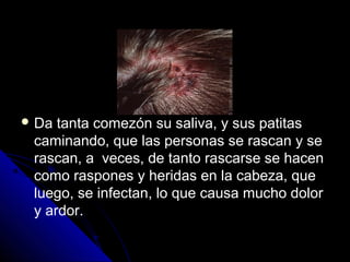  Da tanta comezón su saliva, y sus patitas
caminando, que las personas se rascan y se
rascan, a veces, de tanto rascarse se hacen
como raspones y heridas en la cabeza, que
luego, se infectan, lo que causa mucho dolor
y ardor.
 