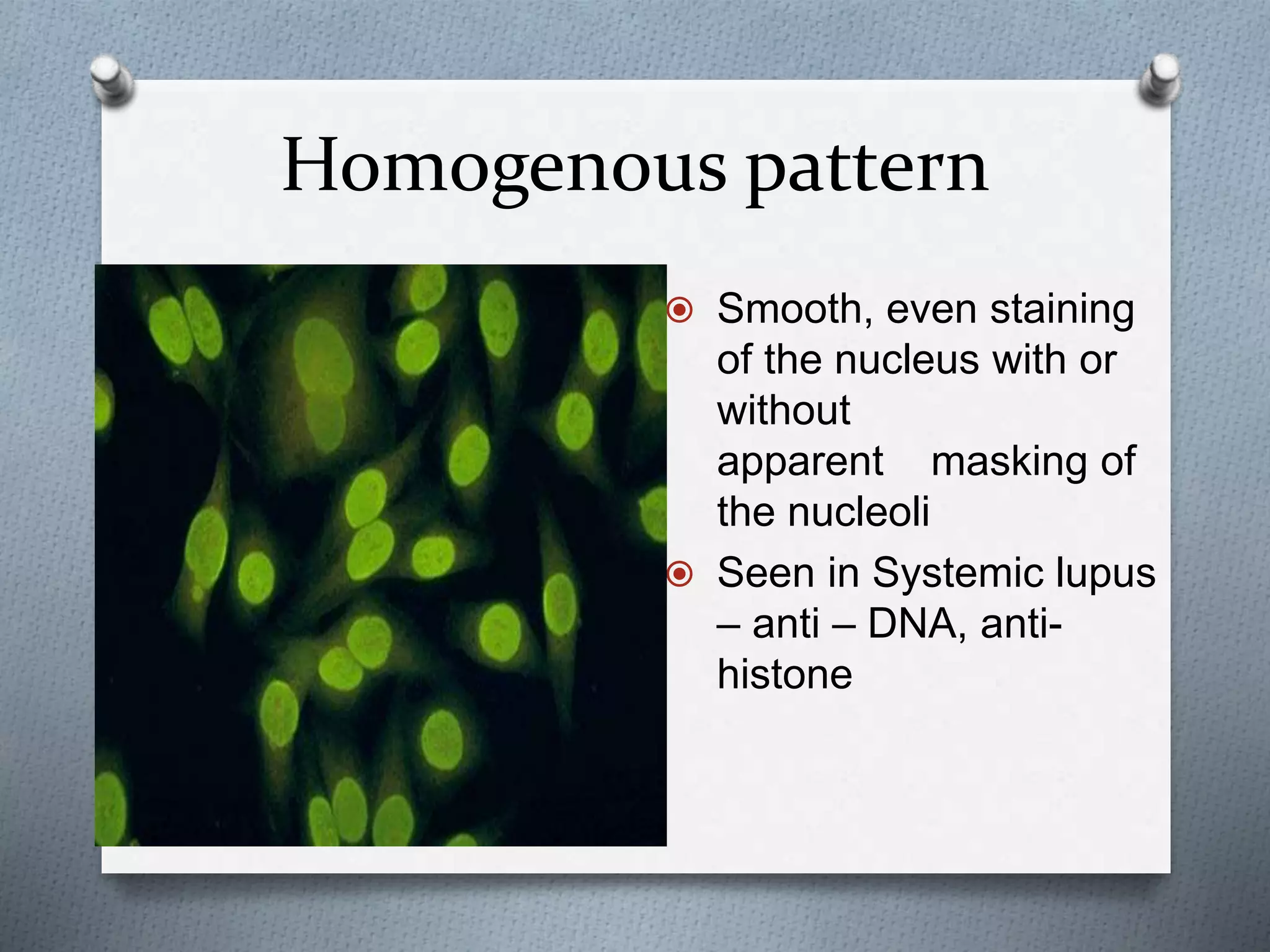 Homogenous pattern
 Smooth, even staining
of the nucleus with or
without
apparent masking of
the nucleoli
 Seen in Systemic lupus
– anti – DNA, anti-
histone
 