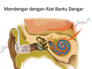 Mendengar dengan Alat Bantu Dengar
 