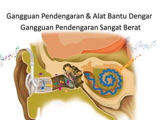 Gangguan Pendengaran & Alat Bantu Dengar
Gangguan Pendengaran Sangat Berat
 