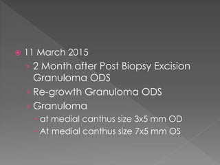  11 March 2015
› 2 Month after Post Biopsy Excision
Granuloma ODS
› Re-growth Granuloma ODS
› Granuloma
 at medial canthus size 3x5 mm OD
 At medial canthus size 7x5 mm OS
 