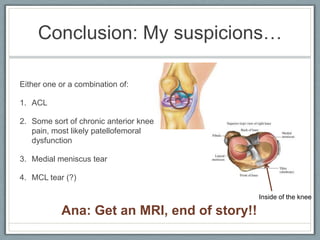 ACL InjuryLargest numbers are sustained in the running/jumping sports: football, basketball, soccer, gymnastics.Usually is a result of a cutting, or turning maneuver or abrupt deceleration. Isolated tears of the menisci or ACL are usually a result of deceleration or rotational forces on the weight-bearing knee as may occur in any running or jumping activity.In jumping activities the injury is caused by a mislanding (not my case but worth to take a note).Isolated sprains or anterior cruciate ligament are almost never the result of contact or collision (contradicts with my right knee’s first and most devastating injury)A snap or pop during a deceleration or cutting maneuver implies ACL or meniscal injury until proven otherwise.