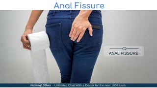 Anal Fissure
 