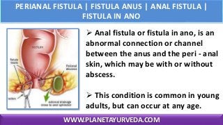 PERIANAL FISTULA | FISTULA ANUS | ANAL FISTULA |
FISTULA IN ANO
 Anal fistula or fistula in ano, is an
abnormal connection or channel
between the anus and the peri - anal
skin, which may be with or without
abscess.
 This condition is common in young
adults, but can occur at any age.
WWW.PLANETAYURVEDA.COM
 