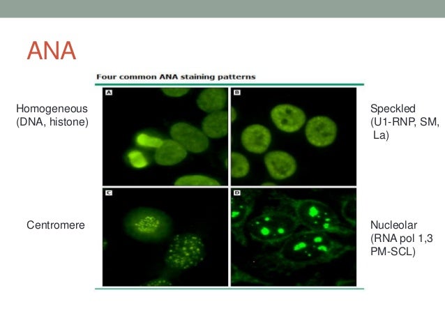 Connective Tissue Diseases