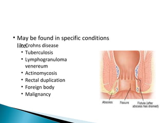 • May be found in specific conditions
like:• Crohns disease
• Tuberculosis
• Lymphogranuloma
venereum
• Actinomycosis
• Rectal duplication
• Foreign body
• Malignancy
 