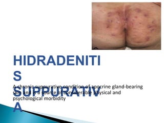 HIDRADENITI
S
SUPPURATIV
A
A chronic suppurative condition of apocrine gland-bearing
skin and is a source of considerable physical and
psychological morbidity
 
